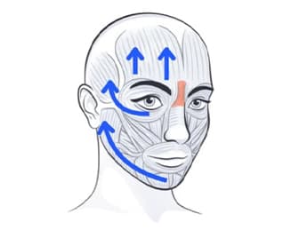 TecnoLift Facial: Abordaje Kinésico